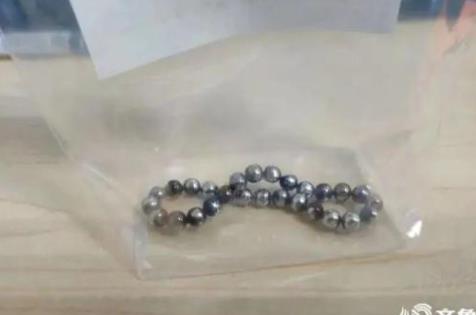 2歲幼童誤吞28顆磁力珠 CT照片曝光實在是太嚇人了