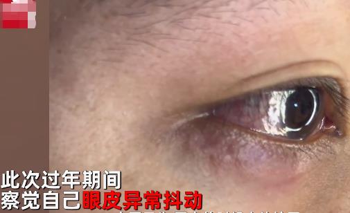 男子左眼皮異常抖動(dòng)有蟲(chóng)游走 畫面曝光簡(jiǎn)直太嚇人了