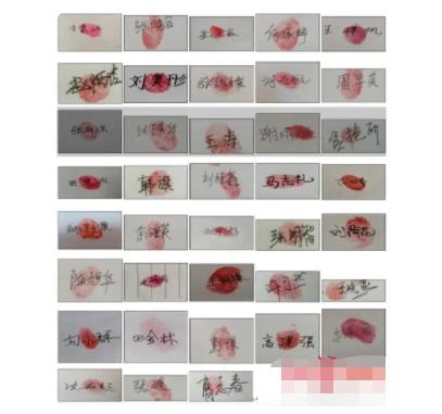 38位戈謝病患者家庭聯(lián)名求藥 真相揭露真的令人大吃一驚