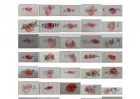 38位戈謝病患者家庭聯(lián)名求藥 真相揭露真的令人大吃一驚