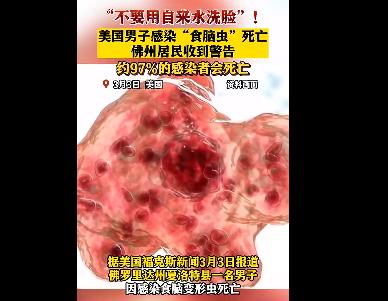 美國男子自來水洗臉感染食腦蟲死亡 原因竟是這樣實(shí)在是太意外了