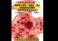 美國男子自來水洗臉感染食腦蟲死亡 原因竟是這樣實(shí)在是太意外了
