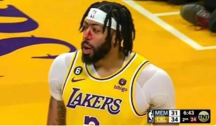 濃眉被打出血 到底是哪場比賽?