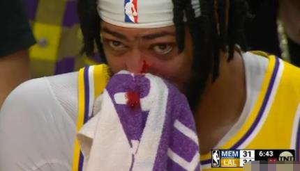 濃眉被打出血 背后真相曝光簡(jiǎn)直太驚人了