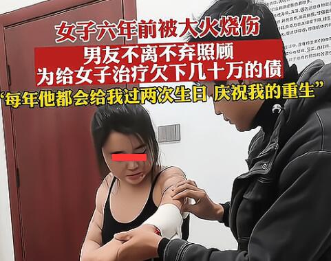 男子照顧大面積燒傷女友6年 原因竟是這樣實(shí)在是太意外了