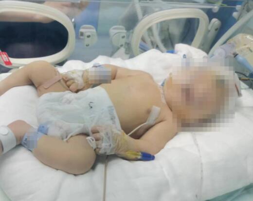 嬰兒出生后顱骨骨折 醫(yī)院回應(yīng) 真相曝光簡直太驚人了