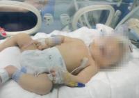 嬰兒出生后顱骨骨折 醫(yī)院回應(yīng) 真相曝光簡(jiǎn)直太驚人了