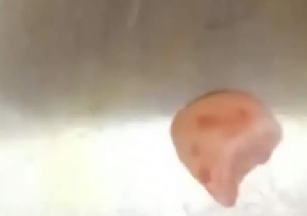 女子摔跤上牙磕進(jìn)嘴唇1月后才發(fā)現(xiàn) 具體事件經(jīng)過(guò)是什么?