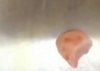 女子摔跤上牙磕進(jìn)嘴唇1月后才發(fā)現(xiàn) 照片曝光實在是太嚇人了