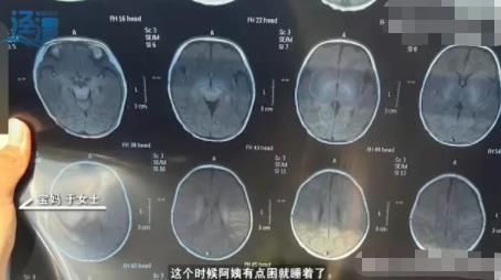 月嫂拍嗝時(shí)打盹致嬰兒頭頂骨骨折 背后原因簡(jiǎn)直驚呆了眾人