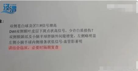 月嫂拍嗝時打盹致嬰兒頭頂骨骨折 背后原因簡直驚呆了眾人