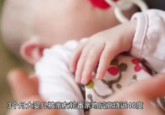 嬰兒被親友輪番親吻高燒近40度 就醫(yī)后孩子被診斷為病毒感染