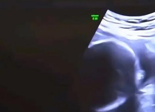 結(jié)婚6年沒孩子 查出丈夫非男性 真相曝光簡直太驚人了