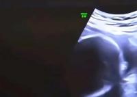 結(jié)婚6年沒(méi)孩子 查出丈夫非男性 真相曝光簡(jiǎn)直太驚人了