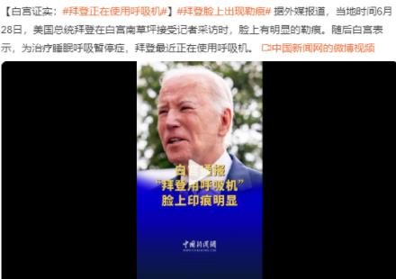 拜登使用呼吸機(jī)治療睡眠呼吸暫停 記者采訪時(shí)臉頰上可以看到勒痕