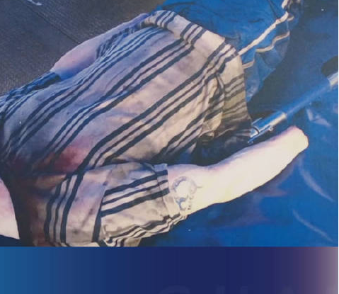 日本札幌一酒店驚現(xiàn)無頭男尸 赤身裸體頭部被刀具切斷帶走