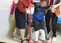 9歲馬蹄足男孩術(shù)后站起來了 照片曝光直接讓人大呼意外