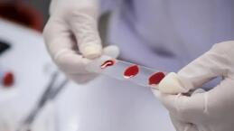 河北發(fā)現(xiàn)比“熊貓血”還罕見的血型 事件始末最新消息