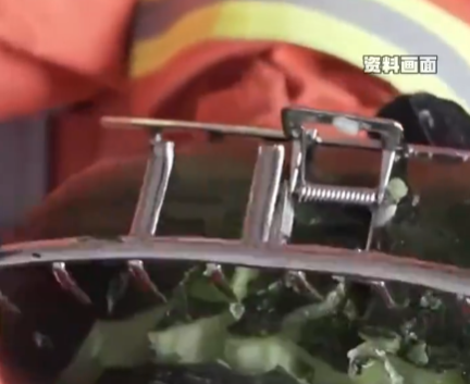 女子戴鯊魚夾騎電車摔倒致頭骨骨折 究竟是怎么回事？