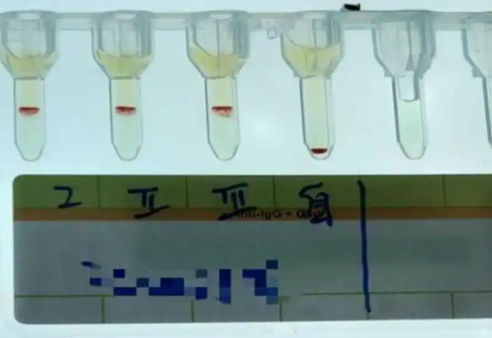 云南檢出一例全球罕見(jiàn)的小p血型 內(nèi)幕曝光簡(jiǎn)直太意外了