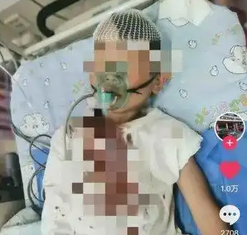 8歲男童被醉漢砸頭 或需做開(kāi)顱手術(shù) 真相簡(jiǎn)直太意外了