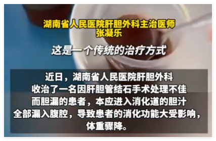 男子每天喝500ml自己的膽汁救命 事件始末2025最新消息