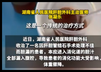 男子每天喝500ml自己的膽汁救命 事件始末2025最新消息