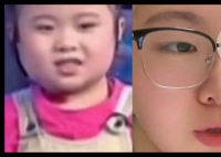 知名童星“秦虹一枝花”右眼失明 原因竟是這樣太無(wú)奈了